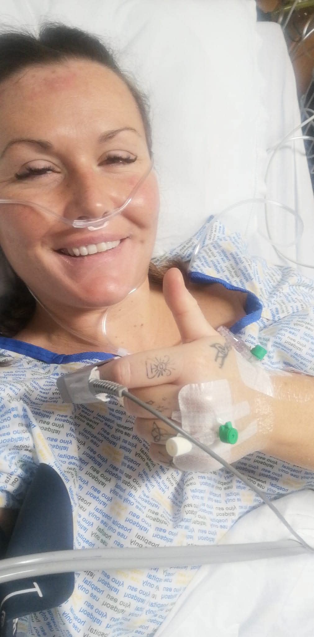 A woman in a hospital bed smiles and gives a thumbs up. She is wearing an oxygen tube and a hospital gown, with medical tubes and an IV attached to her hand.